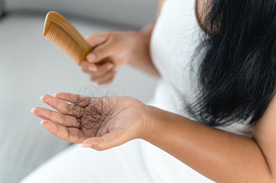 hair loss