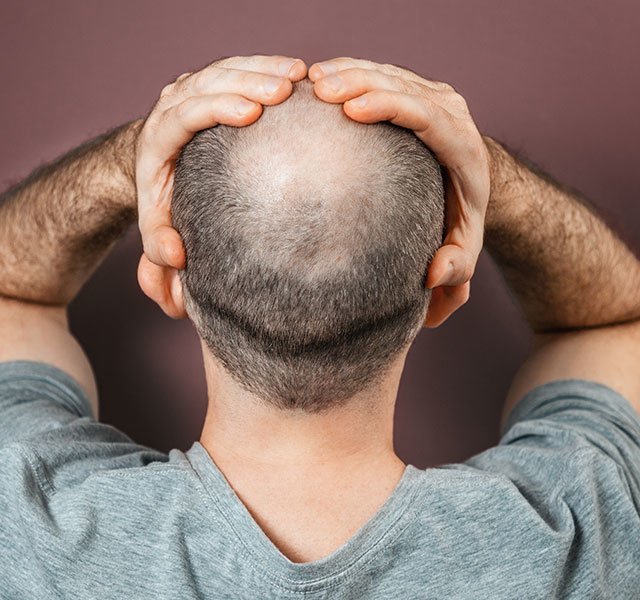 Hair loss cure deals 2021