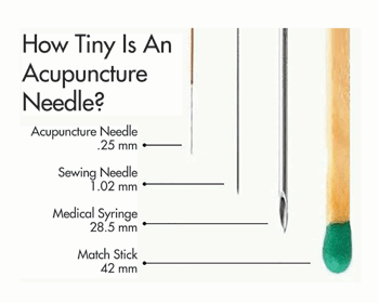 acupuncture needles cancer
